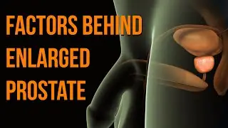 Understanding the Factors Behind Enlarged Prostate