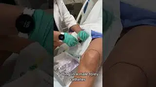 Foley Bladder Catheterization for male #shorts