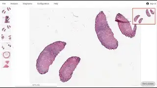 SlideSimple - Open-source tool for histopathology image visualization