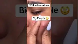 OMG 🥵