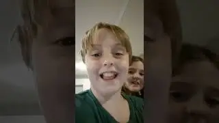 my weird features
