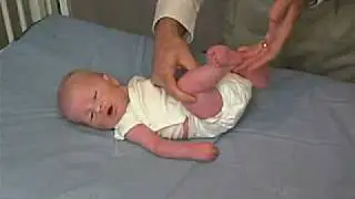 neurology exam: newborn-abnormal: Tone - Popliteal Angle