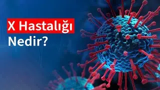 X Hastalığı Nedir? X Hastalığı Belirtileri Nelerdir? | Medical Park