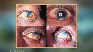 Epidemiology of chronic non-communicable disease and conditions