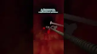 Хоррор игра про путешествие в глубины прямой кишки - Месть толстого кишечника 