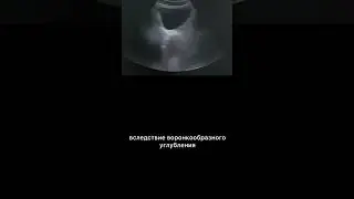 #узи #армдиассистент #турп
