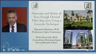 Tear Trough Dermal Filler cannula injection, IMCAS, Paris (Short Vesion)