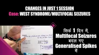 Changes in just 1 Session - West Syndrome - Multifocal Seizures Case | सिर्फ 1 सेशन में आ गया अंतर
