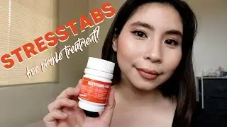 STRESSTABS FOR ACNE TREATMENT | Happy 12k To Us!