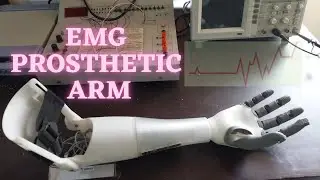 EMG Based Soft Robotic Prosthetic Hand For Amputees