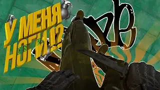У МЕНЯ НОГИ !? ( CS 2 )