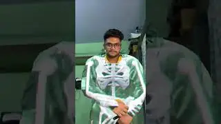 Snapchat AR Lens - Xray Jelly Dress