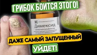 Димексид: МОЩНОЕ СРЕДСТВО Против ГРИБКА и Эффективное Лечение для Ваших Ног!