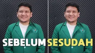 3 Cara Menghilangkan Jerawat dengan Photoshop