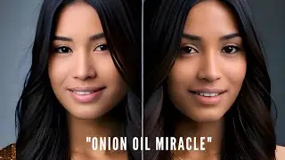 Grow Gorgeous Hair with Onion Oil.. #hairgrowth #hairccare