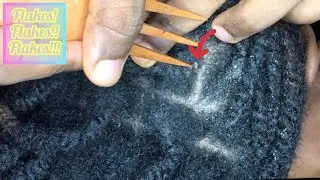 ASMR Up-close and attentive old twist out scratch~ It rained flakes 💆🏾‍♀️ 😴