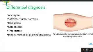 Abscess
