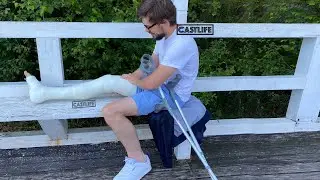 Andy with big full leg cast LLC spending time by the lake PART 1