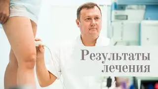 Результаты лечения в центре флебологии до/после