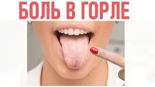 БОЛЬ В ГОРЛЕ | Почему болит горло и что делать