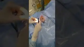 Операция по замене хрусталика, лечение катаракты, cataract surgery