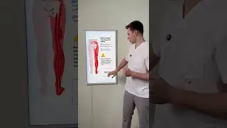 СЕДАЛИЩНЫЙ НЕРВ. ТЕСТ #shorts #ишиас