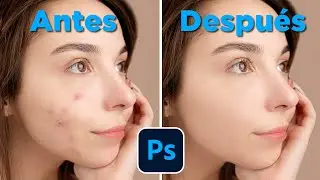 Como LIMPIAR la Piel con Photoshop en SEGUNDOS (Quitar Acné, Espinillas e Imperfecciones)