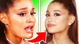 Ariana Grande Finally Speaks on Her FAILED Plastic Surgery