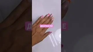 И ПОЧЕМУ ВИДЕО ДО/ПОСЛЕ ТАКИЕ ЗАЛИПАТЕЛЬНЫЕ?