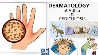 SCABIES & PEDICULOSIS #MADE_EASY