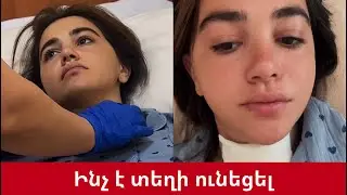ԲԱՑԱՌԻԿ. ինչու է դերասանուհի Ռոզա Դավթյանը վիրահատության ենթարկվել