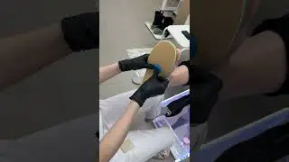 Изготовление разгрузочных стелек быстро, легко и эффективно побороться с болезненными мозолями