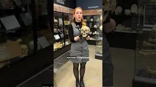 brachycephaly
