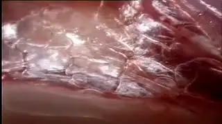 Living Matter:  excursion under the skin