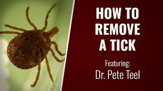Tick Removal Best Practices with Dr. Teel