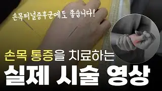 손목터널증후군을 비롯한 손목 통증에 좋은 치료!