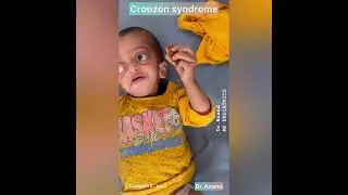 Guess the diagnosis