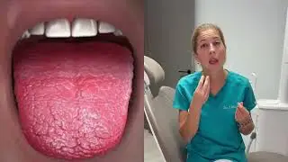 colutorios