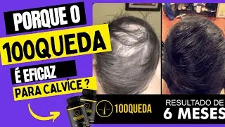 **100QUEDA** - Os resultados surpreendentes de 100QUEDA na prevenção e combate à calvície.