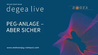 degea live – PEG-Anlage – aber sicher