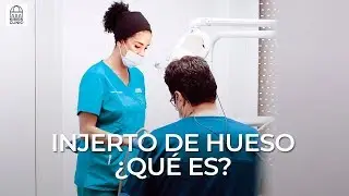 ¿Qué es un injerto de hueso y en qué consiste?