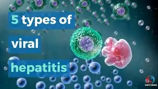 Viral hepatitis (A, B, C, D, E)