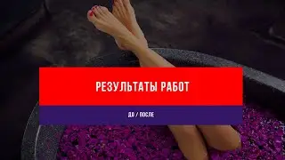 Результаты работ до и после Флеболога Семенова Артема Юрьевича
