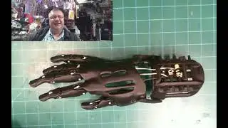 Prosthetic Hand & I need you to tell me where I can find kids who need a prosthetic hand!
