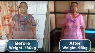 My Weight loss Transformation from 130 kg to 93 kg and Still Losing|Best Bariatric Surgeon|Dr. Kular