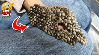 How To Remove Lice