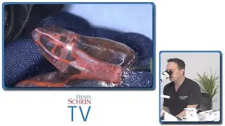 ScheinTV Ep17 Endodontic Innovations
