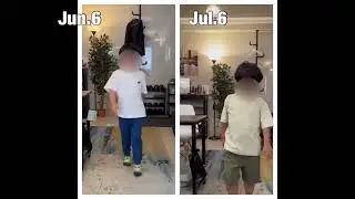 Duchenne muscular dystrophy recovery record as of 3-months treatment