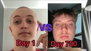 I TOOK A SELFIE EVERYDAY FOR 700 DAYS STRAIGHT🤯 EPIC TRANSFORMATION SINCE I WAS BALD