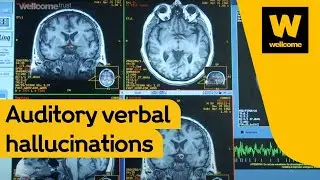 Hearing voices with Professor Charles Fernyhough | Wellcome